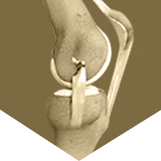 Knee Ligament Reconstruction